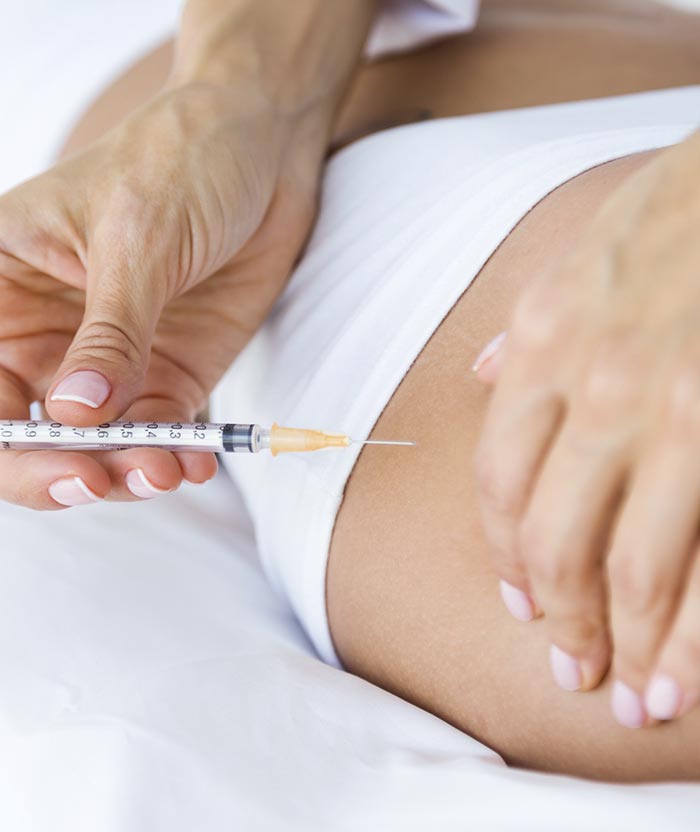 Mesoterapia